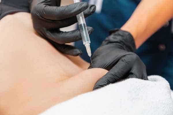 fat dissolving injections