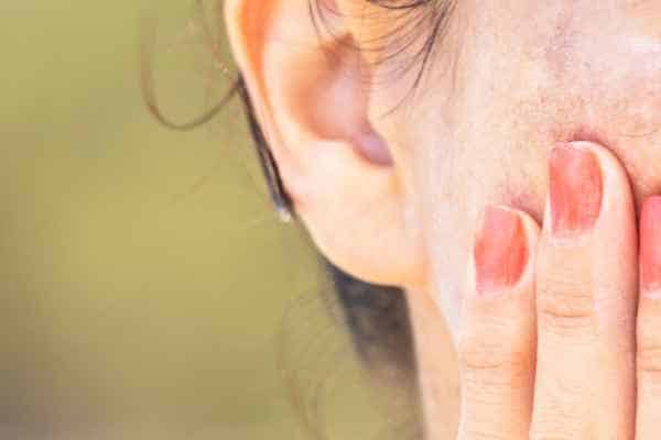 age spots removal